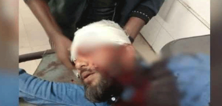 এবার প্রকাশ্যে এনসিপি নেতাকে গুলি