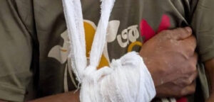 বাহুবলে ১০ দলীয় জোটের প্রচারণায় বাধা সংঘর্ষ, আহত ৭